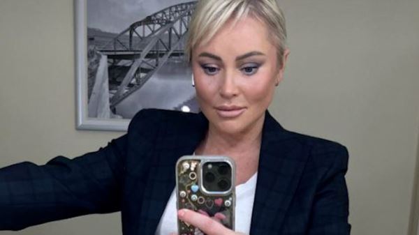 «Брови как у Брежнева»: Дана Борисова показала лицо после пластической операции